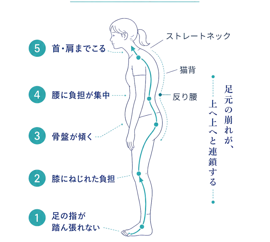 足元から腰への負担のつながりを示した図